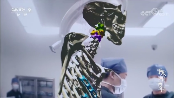 混合現(xiàn)實(shí)手術(shù)紀(jì)錄片